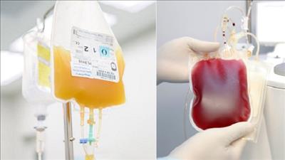Nghiên cứu truyền tế bào gốc và huyết tương để điều trị bệnh nhân Covid-19