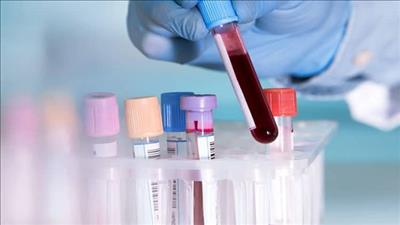 Xét nghiệm máu mới có thể phát hiện hơn 50 loại ung thư