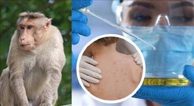 Có bằng chứng động vật có thể lây nhiễm virus đậu mùa khỉ từ người